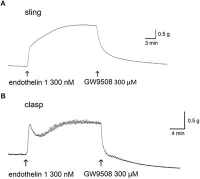 Long-Chain Fatty Acid Receptors Mediate Relaxation of the Porcine Lower Esophageal Sphincter